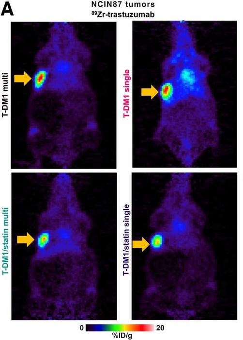 Representative PET images of 89ZrDFO-trastuzumab