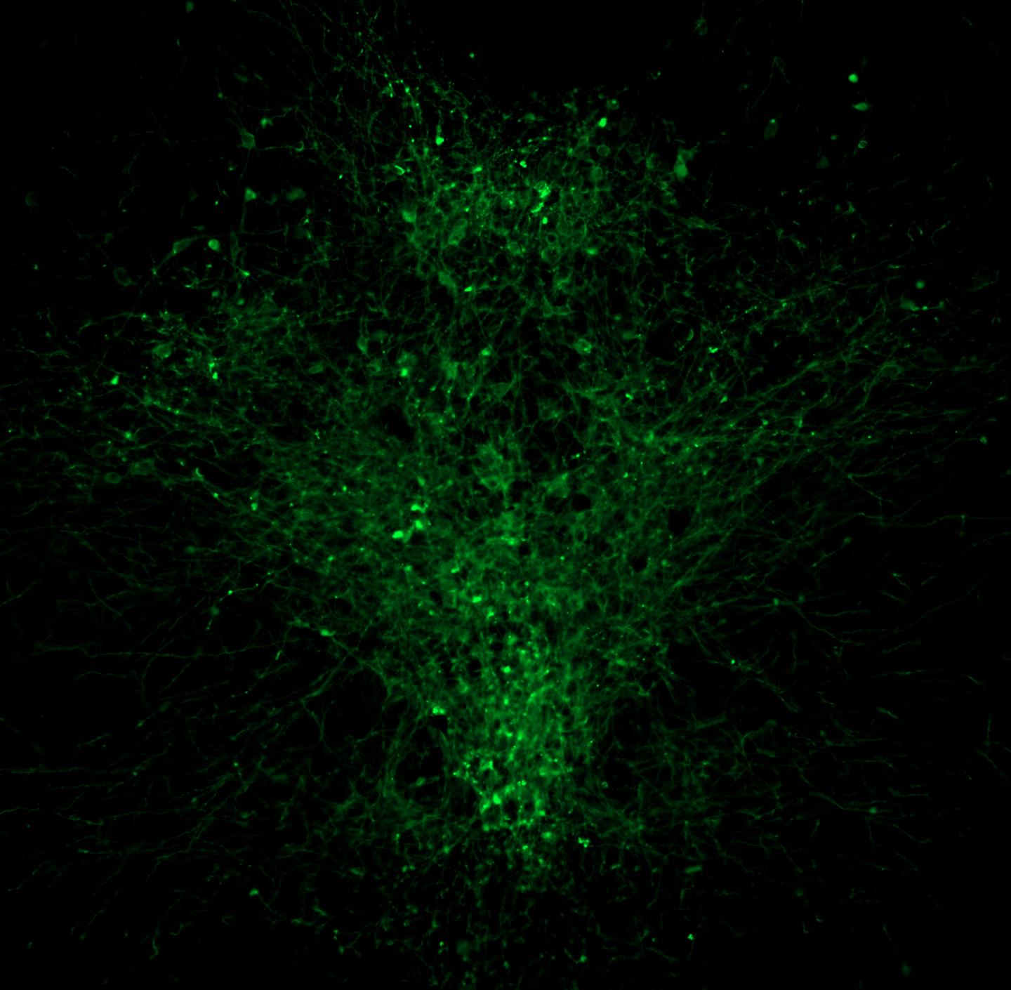 Serotonin Producing Neurons