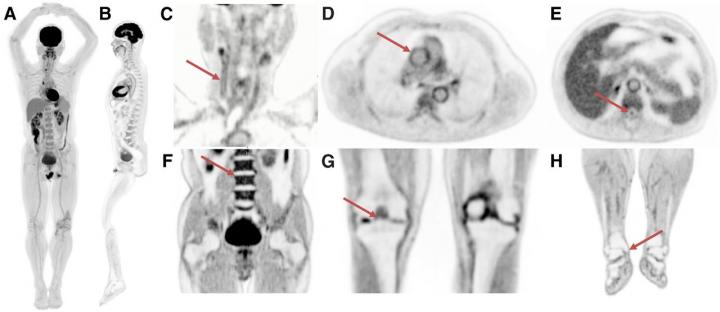 Selected Views from Total-Body Scan