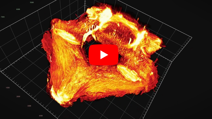 An illuminated 3D tour of lower back pain (video)