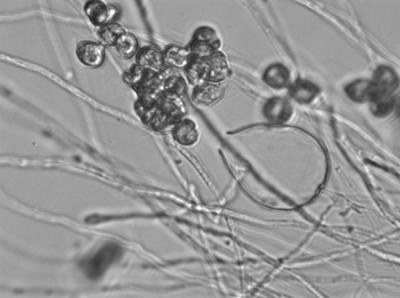 Zoospores from a Sporangia
