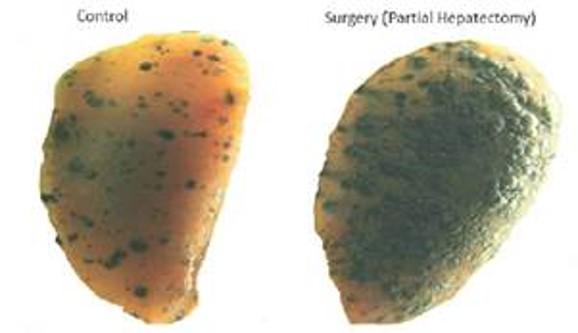 Metastases on Mouse Lungs