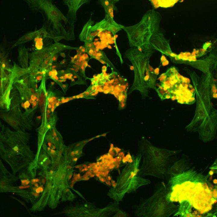 Retinoblastoma Tumor Cells