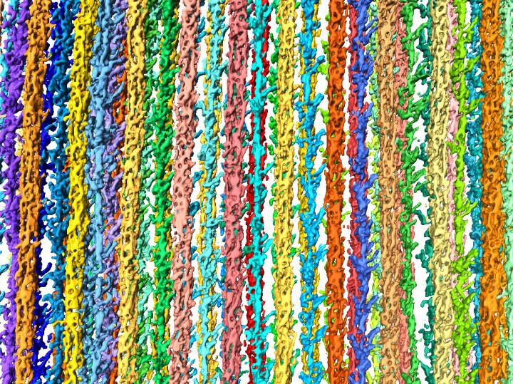 3D-reconstruction of the sarcomere.