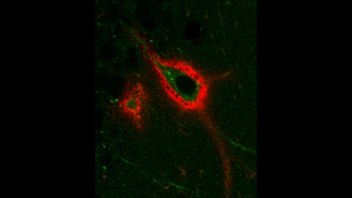 Changes in Brain Cartilage May Explain Why Sleep Helps You Learn