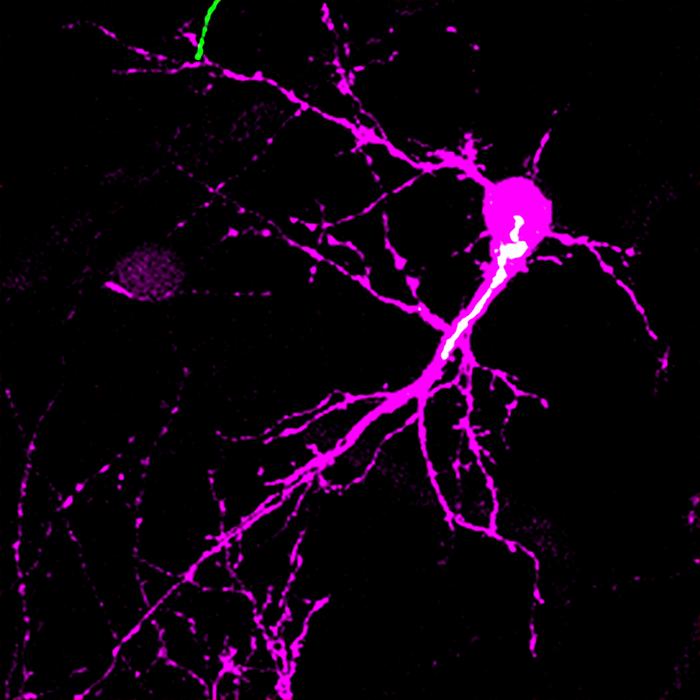 Golgi Polarization