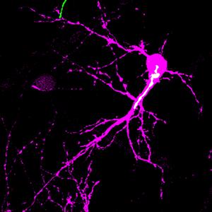 Golgi Polarization