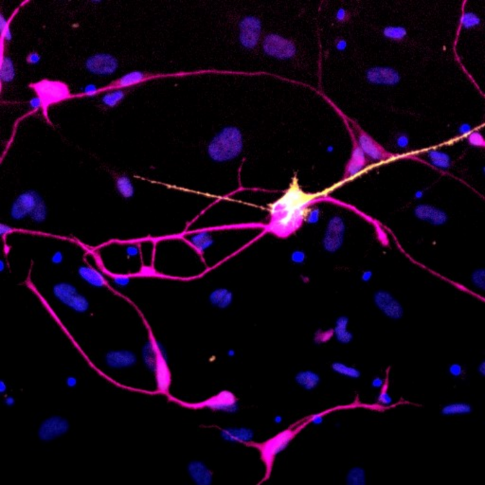 Induced dopaminergic neurons