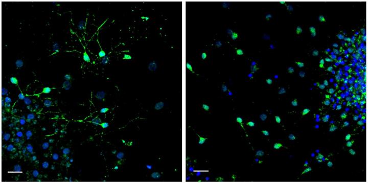 A Blood Factor Involved in Weight Loss and Aging