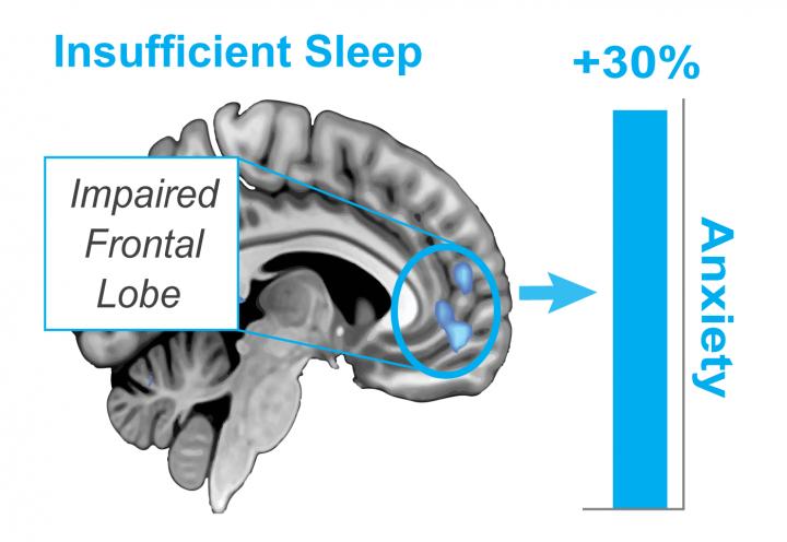 Insufficient Sleep Impairs Frontal Lobe