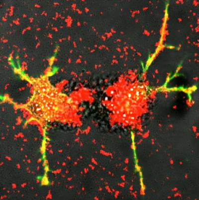 Self-healing Neurons