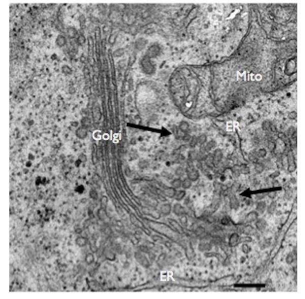 Figure 1. Image of a Cell's Interior without USP8