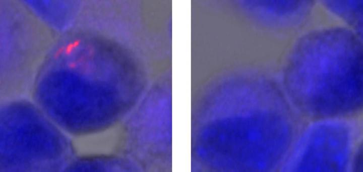 <em>Mycobacterium tuberculosis</em>