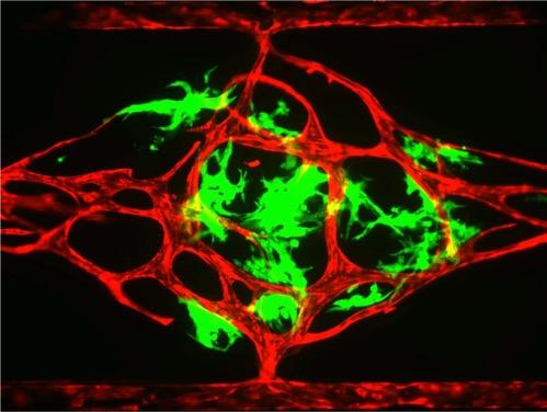 Fluorescent Image of VMT