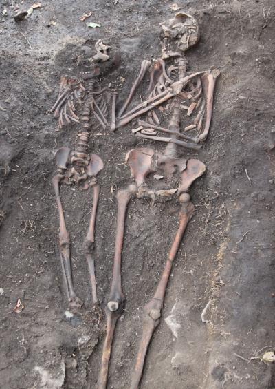 The Skeleton Excavated at the St. Nikolay Church in Oslo, Which Carried Sequences for the Pathogen