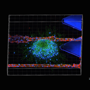 Artificial brain cancer tissue