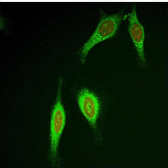 Cervical Cancer Cells