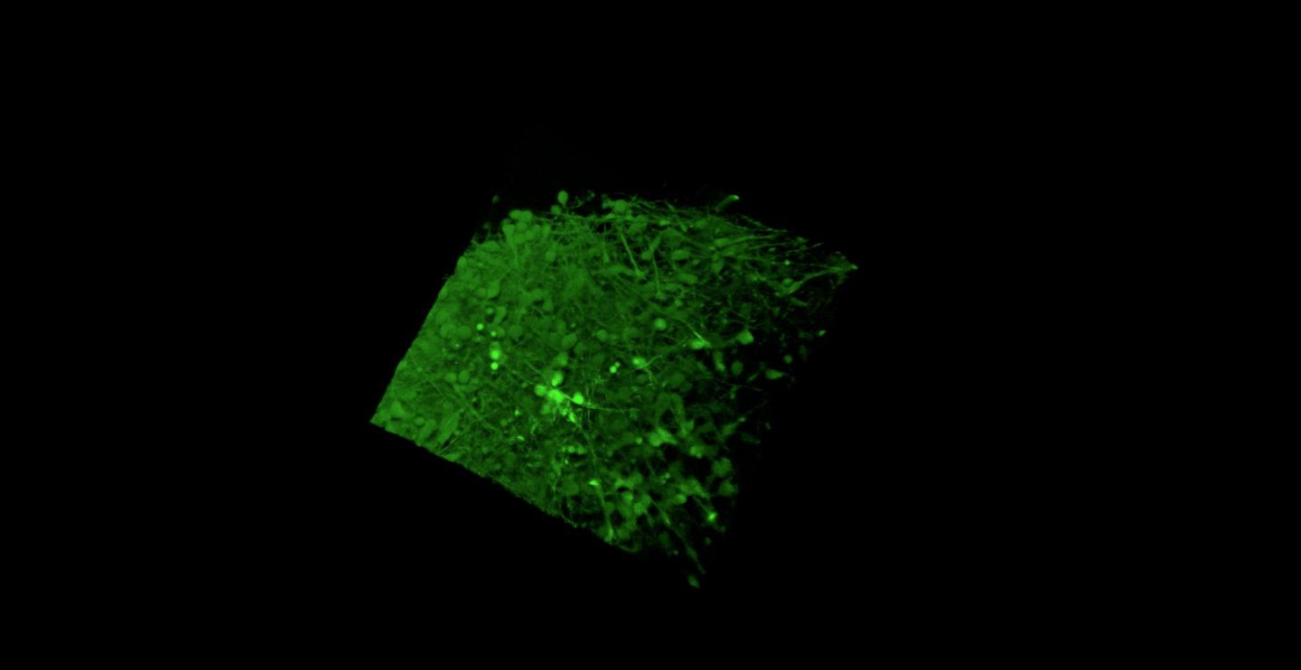 Capturing Neuronal Action in a Lab Dish