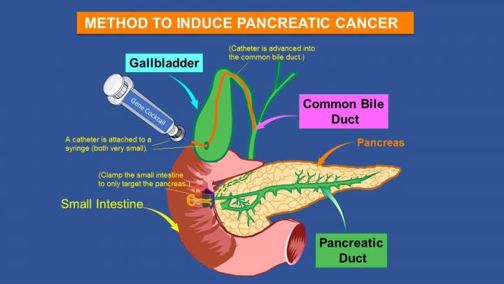 A Novel Method to Induce Pancreatic Cancer