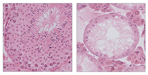 Normal spermatogenesis and Impaired spermatogenesis