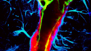 Enhanced glymphatic transport