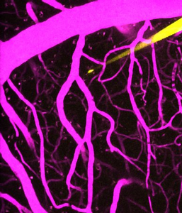 Purple blood vessels in the brain