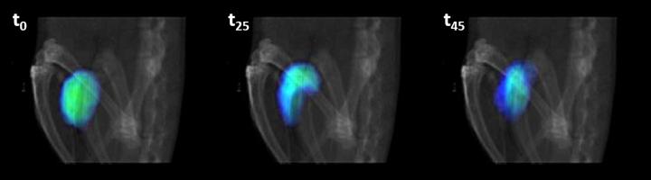 Nanorobots in the presence of urea