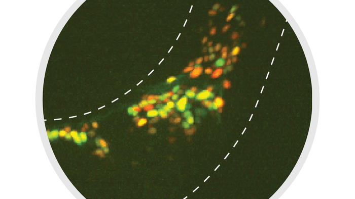 Tracking neurons