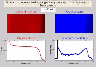 Temporally and Spatially Resolved Imaging of Clot Growth and Thrombin Activity in Blood Plasma