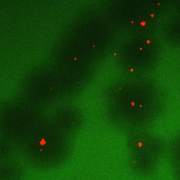 Phage Attack Lung Bacteria