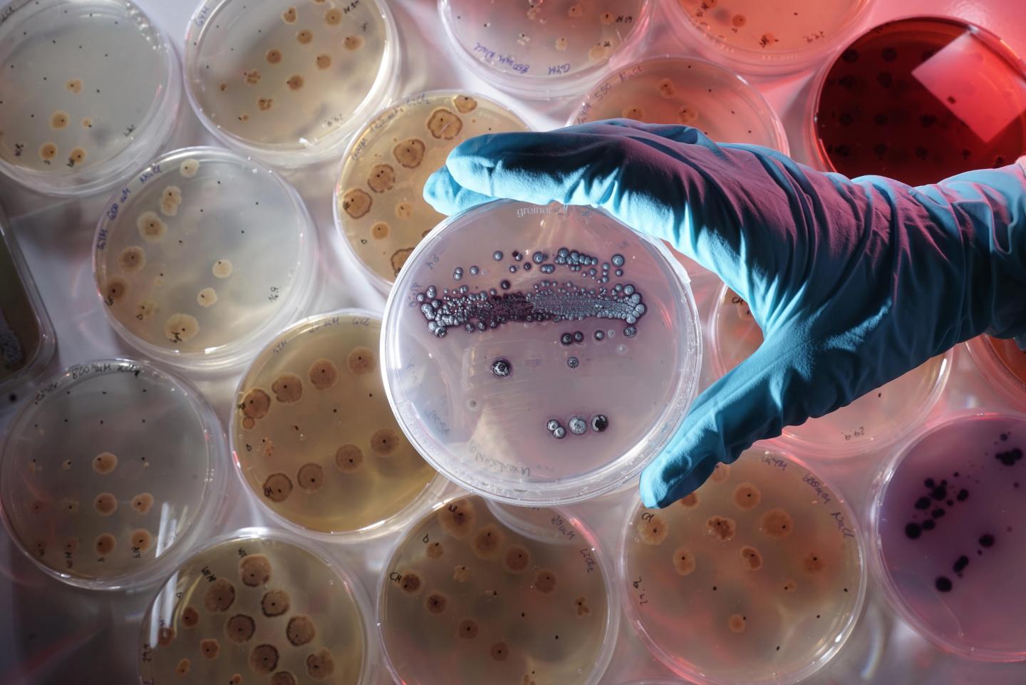 Petri Dish with the Bacterium Streptomyces lividans