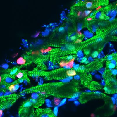 Zebrafish Study with Human Heart Implications (2 of 2)