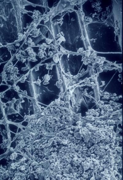 Scanning Electron Micrograph of <i>Ceriporiopsis subvermispora</i>