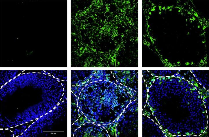 Antioxidant Treatment Prevents Sexual Transmission of Zika in Mice