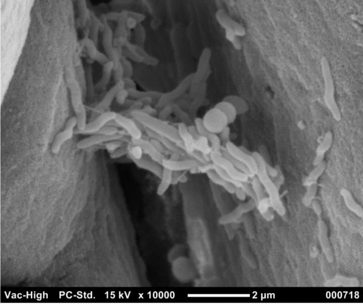 Electron Micrograph of <i>C. jejuni</i> in Chicken Gut