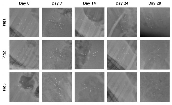 Once-A-Month Oral Contraceptive Could Improve Patient Adherence (1 of 1)