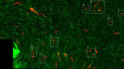 Physical Cues Drive Metatasis