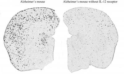 Alzheimer's Mouse