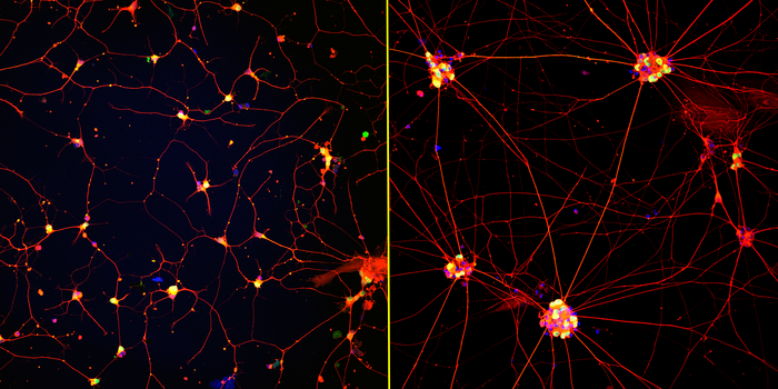 Enhanced neurons