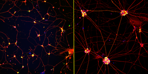 Enhanced neurons