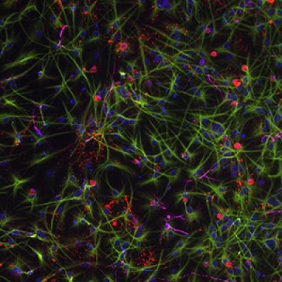 Mouse Study Offers New Clues to Cognitive Decline