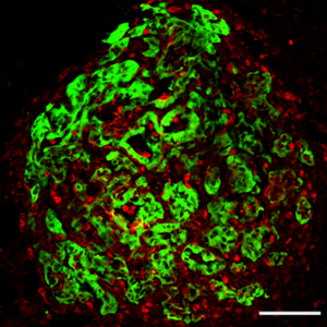 New Lung Immuno-oncology Therapeutic Strategy Identified