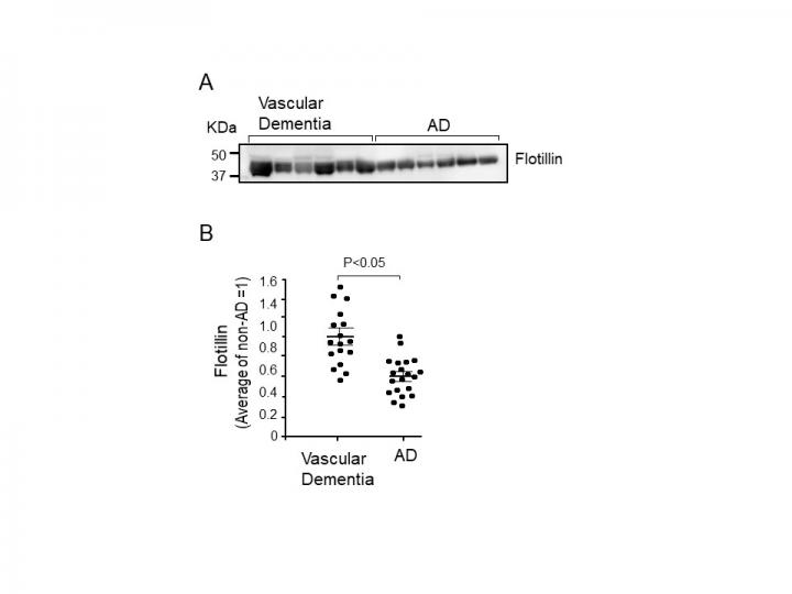 Figure 2) Serum Flotillin Levels in Autopsy Cases with AD Were Lower Than Those in Cases with VD