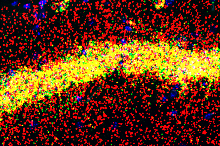 Hippocampal neurons