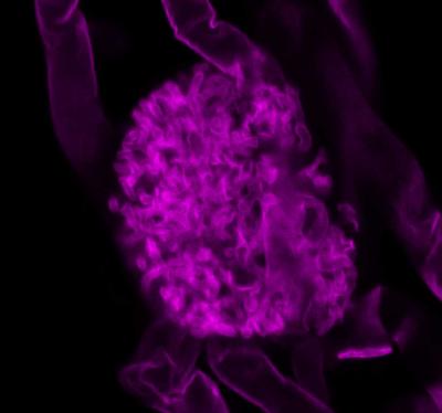 A Fungal Arbuscule Inside a <i>Medicago truncatula</i> Root Cell