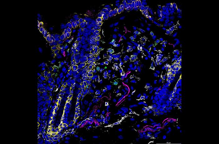 Immunofluorescence imaging