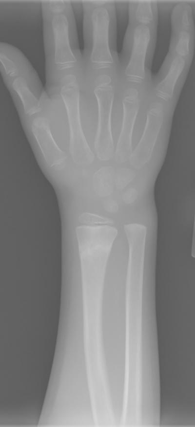 A Typical Radiograph Which Is Provided as An Input to the Model