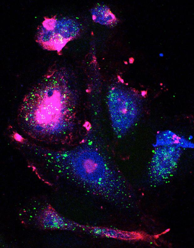 Study Finds New Lethal Combination of Cancer Drugs Shrinks Tumors