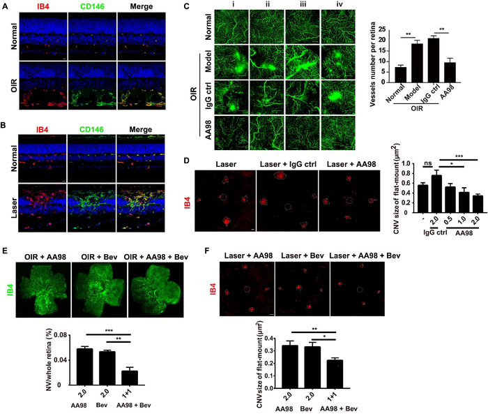 CD146 as a promising therapeutic target for retinal and choroidal neovascularization diseases