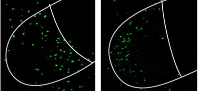 VMHVL Picture from Female Mouse Brain